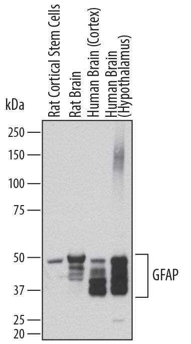 Western blot shows lysates of rat cortical stem cells, rat brain tissue, human brain (cortex) tissue, and human brain (hypothalamus) tissue. PVDF membrane was probed with 0.2 µg/mL of Sheep Anti-Human GFAP Antigen Affinity-purified Polyclonal Antibody (Catalog # AF2594) followed by HRP-conjugated Anti-Sheep IgG Secondary Antibody (Catalog # HAF016). Specific bands were detected for GFAP at approximately 35-50 kDa (as indicated). This experiment was conducted under reducing conditions and using Immunoblot Buffer Group 1.