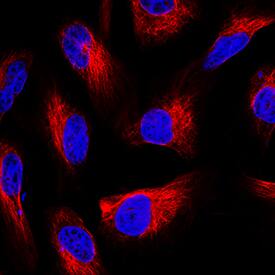 GFAP was detected in immersion fixed U-251MG human glioblastoma cell line using Mouse Anti-Human GFAP Monoclonal Antibody (Catalog # MAB25941) at 1.7 µg/mL for 3 hours at room temperature. Cells were stained using the NorthernLights™ 557-conjugated Anti-Mouse IgG Secondary Antibody (red; NL007) and counterstained with DAPI (blue). Specific staining was localized to cytoplasm. View our protocol for Fluorescent ICC Staining of Cells on Coverslips.