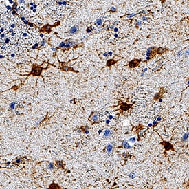 GFAP was detected in immersion fixed paraffin-embedded sections of human brain (caudate nucleus) using Mouse Anti-Human GFAP Monoclonal Antibody (Catalog # MAB25941) at 0.2 µg/mL for 1 hour at room temperature followed by incubation with the Anti-Mouse IgG VisUCyte™ HRP Polymer Antibody (VC001). Tissue was stained using DAB (brown) and counterstained with hematoxylin (blue). Specific staining was localized to glial cells. View our protocol for IHC Staining with VisUCyte HRP Polymer Detection Reagents.