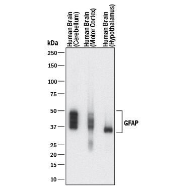 Western blot shows lysates of human brain (cerebellum) tissue, human brain (motor cortex) tissue, and human brain (hypothalamus) tissue. PVDF membrane was probed with 0.25 µg/mL of Mouse Anti-Human GFAP Monoclonal Antibody (Catalog # MAB25941) followed by HRP-conjugated Anti-Mouse IgG Secondary Antibody (HAF018). Specific bands were detected for GFAP at approximately 35-50 kDa (as indicated). This experiment was conducted under reducing conditions and using Immunoblot Buffer Group 1.
