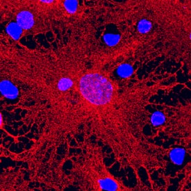 GFAP was detected in immersion fixed differentiated rat cortical stem cells using Mouse Anti-Human GFAP Monoclonal Antibody (Catalog # MAB2594) at 10 µg/mL for 3 hours at room temperature. Cells were stained using the NorthernLights™ 557-conjugated Anti-Mouse IgG Secondary Antibody (red; Catalog # NL007) and counterstained with DAPI (blue). Specific staining was localized to cytoplasm. View our protocol for Fluorescent ICC Staining of Stem Cells on Coverslips.