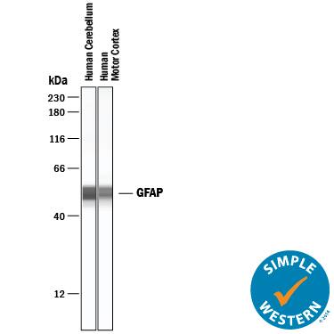 Simple Western lane view shows lysates of human brain (cerebellum) tissue and human brain (motor cortex) tissue, loaded at 0.2 mg/mL. A specific band was detected for GFAP at approximately 51-52 kDa (as indicated) using 50 µg/mL of Mouse Anti-Human GFAP Monoclonal Antibody (Catalog # MAB2594) . This experiment was conducted under reducing conditions and using the 12-230 kDa separation system.