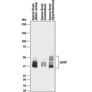 Western blot shows lysates of human brain (motor cortex) tissue, human brain (cerebellum) tissue, and human brain (hypothalamus) tissue. PVDF membrane was probed with 1 µg/mL of Mouse Anti-Human GFAP Monoclonal Antibody (Catalog # MAB2594) followed by HRP-conjugated Anti-Mouse IgG Secondary Antibody (Catalog # HAF018). Specific bands were detected for GFAP at approximately 35-50 kDa (as indicated). This experiment was conducted under reducing conditions and using Immunoblot Buffer Group 1.
