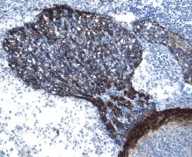 Immunohistochemistry GFR alpha-3/GDNF R alpha-3 Antibody [Unconjugated]