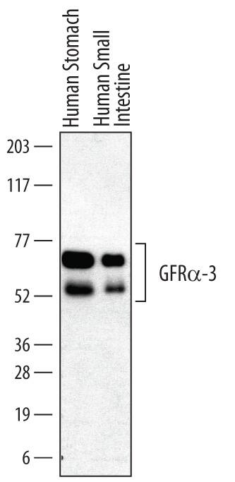 Western blot shows lysates of human stomach tissue and human small intestine tissue. PVDF membrane was probed with 0.2 µg/mL of Goat Anti-Human GFRa-3/GDNF Ra-3 Antigen Affinity-purified Polyclonal Antibody (Catalog # AF670) followed by HRP-conjugated Anti-Goat IgG Secondary Antibody (Catalog # HAF109). Specific bands were detected for GFRa-3/GDNF Ra-3 at approximately 55 and 65 kDa (as indicated). This experiment was conducted under reducing conditions and using Immunoblot Buffer Group 1.