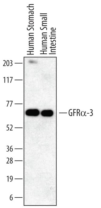 Western blot shows lysates of human stomach tissue and human small intestine tissue. PVDF membrane was probed with 1 µg/mL of Mouse Anti-Human GFRa-3/GDNF Ra-3 Monoclonal Antibody (Catalog # MAB6701) followed by HRP-conjugated Anti-Mouse IgG Secondary Antibody (Catalog # HAF007). A specific band was detected for GFRa-3/GDNF Ra-3 at approximately 65 kDa (as indicated). This experiment was conducted under reducing conditions and using Immunoblot Buffer Group 1.