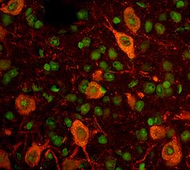 Immunohistochemistry GFR alpha-like Antibody [Unconjugated]