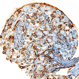 Immunohistochemistry GFR alpha-2/GDNF R alpha-2 Antibody [Unconjugated]