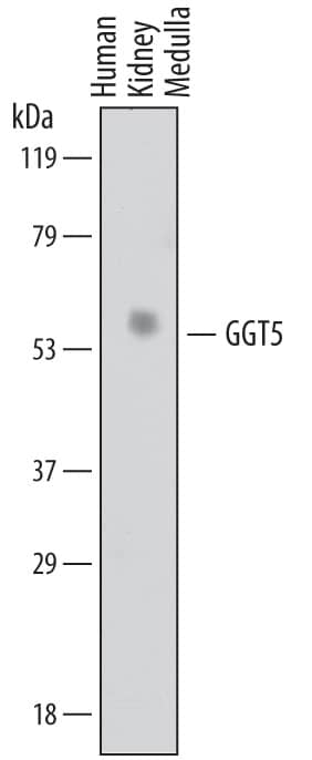 Western Blot GGT5 Antibody