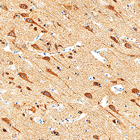GIT1 was detected in immersion fixed paraffin-embedded sections of human brain (cortex) using Rabbit Anti-Human GIT1 Antigen Affinity-purified Polyclonal Antibody (Catalog # AF8508) at 0.3 µg/mL overnight at 4 °C. Tissue was stained using the Anti-Rabbit HRP-DAB Cell & Tissue Staining Kit (brown; Catalog # CTS005) and counterstained with hematoxylin (blue). Specific staining was localized to neurons. View our protocol for Chromogenic IHC Staining of Paraffin-embedded Tissue Sections.