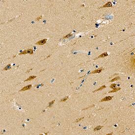 GIT1 was detected in immersion fixed paraffin-embedded sections of human brain (hippocampus) using Mouse Anti-Human GIT1 Monoclonal Antibody (Catalog # MAB8508) at 15 µg/mL overnight at 4 °C. Tissue was stained using the Anti-Mouse HRP-DAB Cell & Tissue Staining Kit (brown; Catalog # CTS002) and counterstained with hematoxylin (blue). Specific staining was localized to neurons. View our protocol for Chromogenic IHC Staining of Paraffin-embedded Tissue Sections.