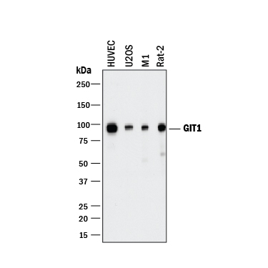 Western blot shows lysates of HUVEC human umbilical vein endothelial cells, U2OS human osteosarcoma cell line, M1 mouse myeloid leukemia cell line, and Rat-2 rat embryonic fibroblast cell line. PVDF membrane was probed with 2 µg/mL of Mouse Anti-Human GIT1 Monoclonal Antibody (Catalog # MAB8508) followed by HRP-conjugated Anti-Mouse IgG Secondary Antibody (Catalog # HAF018). A specific band was detected for GIT1 at approximately 95 kDa (as indicated). This experiment was conducted under reducing conditions and using Immunoblot Buffer Group 1.