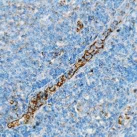 GITR/TNFRSF18 was detected in immersion fixed paraffin-embedded sections of human tonsil using Goat Anti-Human GITR/TNFRSF18 Antigen Affinity-purified Polyclonal Antibody (Catalog # AF689) at 10 µg/mL overnight at 4 °C. Tissue was stained using the Anti-Goat HRP-DAB Cell & Tissue Staining Kit (brown; Catalog # CTS008) and counterstained with hematoxylin (blue). Specific staining was localized to trabeculae sinuses . View our protocol for Chromogenic IHC Staining of Paraffin-embedded Tissue Sections.
