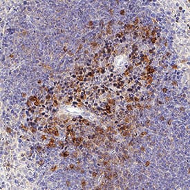 GITR/TNFRSF18 was detected in immersion fixed frozen sections of mouse spleen using Rabbit Anti-Mouse GITR/TNFRSF18 Monoclonal Antibody (Catalog # MAB52412) at 3 µg/mL for 1 hour at room temperature followed by incubation with the Anti-Rabbit IgG VisUCyte™ HRP Polymer Antibody (Catalog # VC003). Tissue was stained using DAB (brown) and counterstained with hematoxylin (blue). Specific staining was localized to lymphocytes. View our protocol for IHC Staining with VisUCyte HRP Polymer Detection Reagents.