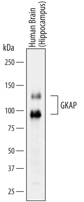 Western blot shows lysates of human brain (hippocampus) tissue. PVDF membrane was probed with 1 µg/mL of Sheep Anti-Human GKAP/DLGAP1 Antigen Affinity-purified Polyclonal Antibody (Catalog # AF7296) followed by HRP-conjugated Anti-Sheep IgG Secondary Antibody (Catalog # HAF016). Specific band were detected for GKAP/DLGAP1 at approximately 80 kDa and 130 kDa (as indicated). This experiment was conducted under reducing conditions and using Immunoblot Buffer Group 8.