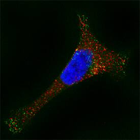 a-Galactosidase A/GLA was detected in immersion fixed HeLa human cervical epithelial carcinoma cell line using Sheep Anti-Human a-Galactosidase A/GLA Antigen Affinity-purified Polyclonal Antibody (Catalog # AF6146) at 15 µg/mL for 3 hours at room temperature. Cells were stained using the Northern-Lights™ 557-conjugated Anti-Sheep IgG Secondary Antibody (red; Catalog # <a class=