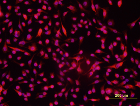 Immunocytochemistry GLI-1 Antibody [Unconjugated]