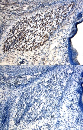 GLI-2 was detected in immersion fixed frozen sections of mouse embryo (15 d.p.c.) using Goat Anti-Mouse GLI-2 Antigen Affinity-purified Polyclonal Antibody (Catalog # AF3635) at 15 µg/mL overnight at 4 °C. Tissue was stained using the Anti-Goat HRP-DAB Cell & Tissue Staining Kit (brown; Catalog # CTS008) and counterstained with hematoxylin (blue). Lower panel shows a lack of labeling when primary antibodies are omitted and tissue is stained only with secondary antibody followed by incubation with detection reagents. Specific staining was localized to developing muscle. View our protocol for Chromogenic IHC Staining of Frozen Tissue Sections.