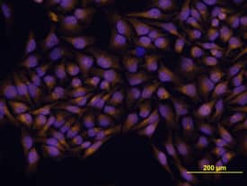 Immunocytochemistry GLI-3 Antibody