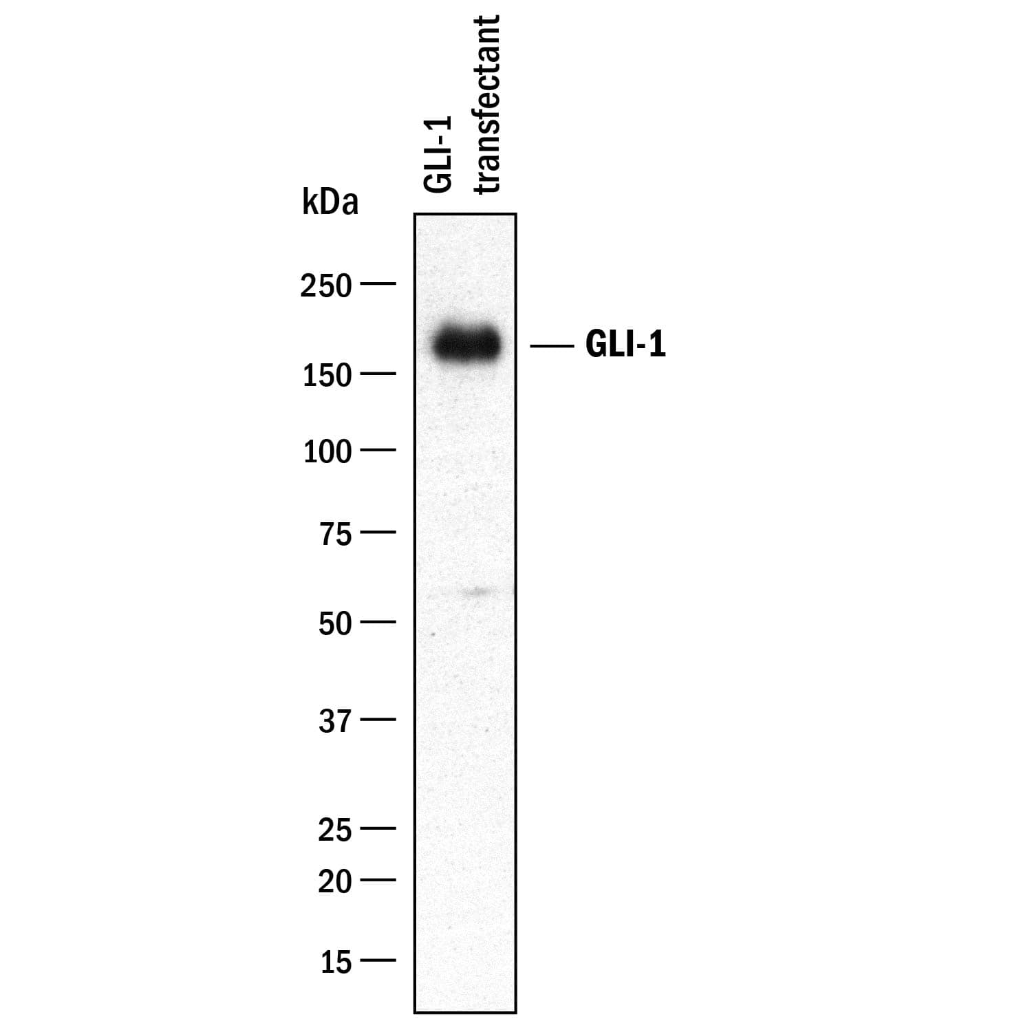 Western Blot GLI-1 Antibody [Unconjugated]