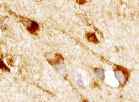 GLP-1R was detected in immersion fixed paraffin-embedded sections of human brain (hippocampus) using 3 µg/mL Mouse Anti-Human GLP-1R Monoclonal Antibody (Catalog # MAB28141) overnight at 4 °C. Tissue was stained with the Anti-Mouse HRP-DAB Cell & Tissue Staining Kit (brown; Catalog # CTS002) and counter-stained with hematoxylin (blue). View our protocol for Chromogenic IHC Staining of Paraffin-embedded Tissue Sections.