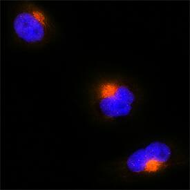GM130/GOLGA2 was detected in immersion fixed HeLa human cervical epithelial carcinoma cell line using Sheep Anti-Human GM130/GOLGA2 Antigen Affinity-purified Polyclonal Antibody (Catalog # AF8199) at 1.7 µg/mL for 3 hours at room temperature. Cells were stained using the NorthernLights™ 557-conjugated Anti-Sheep IgG Secondary Antibody (red; Catalog # NL010) and counterstained with DAPI (blue). Specific staining was localized to Golgi apparatus vesicles. View our protocol for Fluorescent ICC Staining of Cells on Coverslips.