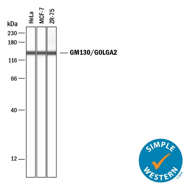 Simple Western lane view shows lysates of HeLa human cervical epithelial carcinoma cell line, MCF-7 human breast cancer cell line, and ZR-75 human breast cancer cell line, loaded at 0.2 mg/mL. A specific band was detected for GM130/GOLGA2 at approximately 141 kDa (as indicated) using 50 µg/mL of Sheep Anti-Human GM130/GOLGA2 Antigen Affinity-purified Polyclonal Antibody (Catalog # AF8199) followed by 1:50 dilution of HRP-conjugated Anti-Sheep IgG Secondary Antibody (Catalog # HAF016). This experiment was conducted under reducing conditions and using the 12-230 kDa separation system.