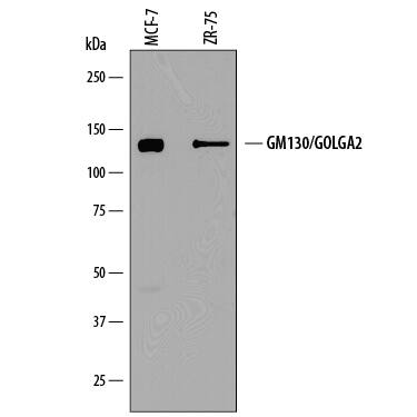 Western blot shows lysates of MCF-7 human breast cancer cell line and ZR-75 human breast cancer cell line. PVDF membrane was probed with 0.25 µg/mL of Sheep Anti-Human GM130/GOLGA2 Antigen Affinity-purified Polyclonal Antibody (Catalog # AF8199) followed by HRP-conjugated Anti-Sheep IgG Secondary Antibody (Catalog # HAF016). A specific band was detected for GM130/GOLGA2 at approximately 130 kDa (as indicated). This experiment was conducted under reducing conditions and using Immunoblot Buffer Group 1.