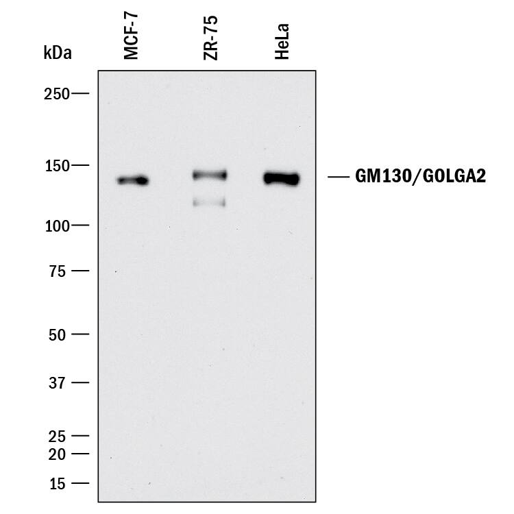 Western blot shows lysates of MCF-7 human breast cancer cell line, ZR-75 human breast cancer cell line, and HeLa human cervical epithelial carcinoma cell line. PVDF membrane was probed with 1 µg/mL of Rabbit Anti-Human GM130/GOLGA2 Monoclonal Antibody (Catalog # MAB81991) followed by HRP-conjugated Anti-Rabbit IgG Secondary Antibody (Catalog # HAF008). A specific band was detected for GM130/ GOLGA2 at approximately 130 kDa (as indicated). This experiment was conducted under reducing conditions and using Immunoblot Buffer Group 1.