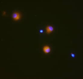 GM-CSF was detected in immersion fixed differentiated human dendritic cells using Mouse Anti-Human GM-CSF Monoclonal Antibody (Catalog # MAB215R) at 10 µg/mL for 3 hours at room temperature. Cells were stained using the NorthernLights™ 557-conjugated Anti-Mouse IgG Secondary Antibody (yellow; Catalog # NL007) and counterstained with DAPI (blue). Specific staining was localized to cytoplasm. View our protocol for Fluorescent ICC Staining of Non-adherent Cells.