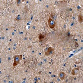GPER was detected in immersion fixed paraffin-embedded sections of human brain (hypothalamus) using Mouse Anti-Human GPER Monoclonal Antibody (Catalog # MAB5534) at 15 µg/mL overnight at 4 °C. Before incubation with the primary antibody, tissue was subjected to heat-induced epitope retrieval using Antigen Retrieval Reagent-Basic (Catalog # CTS013). Tissue was stained using the Anti-Mouse HRP-DAB Cell & Tissue Staining Kit (brown; Catalog # CTS002) and counterstained with hematoxylin (blue). Specific staining was localized to neuronal cytoplasm. View our protocol for Chromogenic IHC Staining of Paraffin-embedded Tissue Sections.