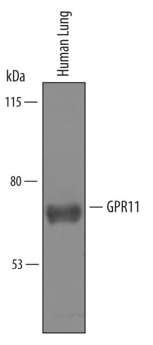 Western Blot GPR111 Antibody