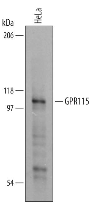 Western Blot GPR115 Antibody