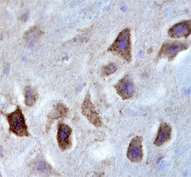 Immunohistochemistry GPR12 Antibody (584940) [Unconjugated]