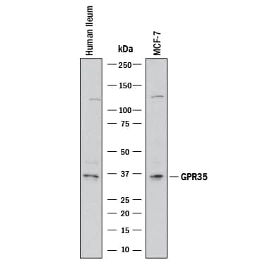 Western blot shows lysates of human ileum tissue and MCF-7 human breast cancer cell line. PVDF membrane was probed with 2 µg/mL of Mouse Anti-Human GPR35 Monoclonal Antibody (Catalog # MAB10181) followed by HRP-conjugated Anti-Mouse IgG Secondary Antibody (Catalog # HAF018). A specific band was detected for GPR35 at approximately 34 kDa (as indicated). This experiment was conducted under reducing conditions and using Immunoblot Buffer Group 1.
