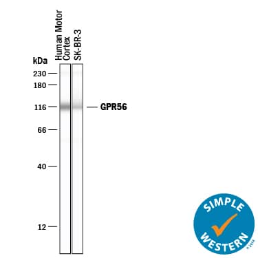 Simple Western lane view shows lysates of human brain (motor cortex) tissue and SK-BR-3 human breast cancer cell line, loaded at 0.2 mg/mL. A specific band was detected for GPR56 at approximately 116 kDa (as indicated) using 10 µg/mL of Sheep Anti-Human GPR56 Antigen Affinity-purified Polyclonal Antibody (Catalog # AF4634) followed by 1:50 dilution of HRP-conjugated Anti-Sheep IgG Secondary Antibody (Catalog # HAF016). This experiment was conducted under reducing conditions and using the 12-230 kDa separation system. Non-specific interaction with the 230 kDa Simple Western standard may be seen with this antibody.