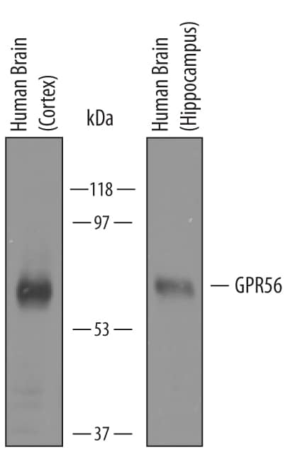 Western blot shows lysates of human brain (cortex) tissue and human brain (hippocampus) tissue. PVDF membrane was probed with 1 µg/mL of Sheep Anti-Human GPR56 Antigen Affinity-purified Polyclonal Antibody (Catalog # AF4634) followed by HRP-conjugated Anti-Sheep IgG Secondary Antibody (Catalog # HAF016). A specific band was detected for GPR56 at approximately 65 kDa (as indicated). This experiment was conducted under reducing conditions and using Immunoblot Buffer Group 8.