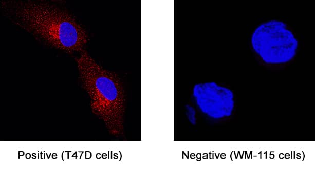 GPR56 was detected in immersion fixed T47D human breast cancer cell line (left panel; positive staining) and WM-115 human malignant melanoma cell line (right panel; negative staining) using Rabbit Anti-Human GPR56 Monoclonal Antibody (Catalog # MAB46361) at 3 µg/mL for 3 hours at room temperature. Cells were stained using the NorthernLights™ 557-conjugated Anti-Rabbit IgG Secondary Antibody (red; Catalog # NL004) and counterstained with DAPI (blue). Specific staining was localized to cytoplasm. View our protocol for Fluorescent ICC Staining of Cells on Coverslips.