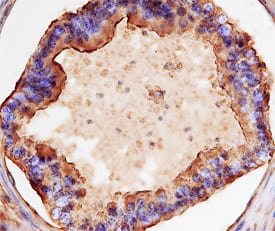 Immunohistochemistry GPR64 Antibody [Unconjugated]