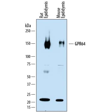 Western blot shows lysates of rat epididymis tissue and mouse epididymis tissue. PVDF membrane was probed with 2 µg/mL of Sheep Anti-Human/Mouse/Rat GPR64 Antigen Affinity-purified Polyclonal Antibody (Catalog # AF7977) followed by HRP-conjugated Anti-Sheep IgG Secondary Antibody (Catalog # HAF016). A specific band was detected for GPR64 at approximately 150 kDa (as indicated). This experiment was conducted under reducing conditions and using Immunoblot Buffer Group 1.