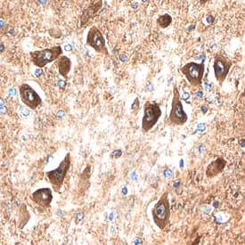GPR75 was detected in immersion fixed paraffin-embedded sections of human brain (hippocampus) using Mouse Anti-Human GPR75 Monoclonal Antibody (Catalog # MAB6728) at 15 µg/mL overnight at 4 °C. Before incubation with the primary antibody, tissue was subjected to heat-induced epitope retrieval using Antigen Retrieval Reagent-Basic (Catalog # CTS013). Tissue was stained using the Anti-Mouse HRP-DAB Cell & Tissue Staining Kit (brown; Catalog # CTS002) and counterstained with hematoxylin (blue). Specific staining was localized to neuronal cell bodies. View our protocol for Chromogenic IHC Staining of Paraffin-embedded Tissue Sections.