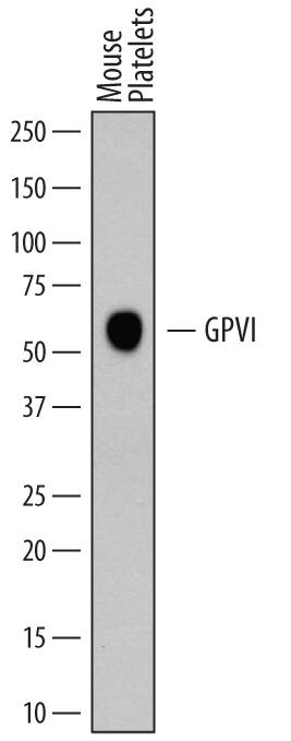 Western blot shows lysates of mouse platelets. PVDF membrane was probed with 1 µg/mL of Sheep Anti-Mouse GPVI Antigen Affinity-purified Polyclonal Antibody (Catalog # AF6758) followed by HRP-conjugated Anti-Sheep IgG Secondary Antibody (Catalog # HAF016). A specific band was detected for GPVI at approximately 60 kDa (as indicated). This experiment was conducted under reducing conditions and using Immunoblot Buffer Group 5.