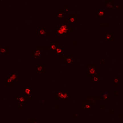 GPVI was detected in immersion fixed adult mouse platelets using Rat Anti-Mouse GPVI Monoclonal Antibody (Catalog # MAB6758) at 10 µg/mL for 3 hours at room temperature. Cells were stained using the NorthernLights™ 557-conjugated Anti-Rat IgG Secondary Antibody (red; Catalog # NL013) and counterstained with DAPI. Specific staining was localized to cell surfaces and cytoplasm. View our protocol for Fluorescent ICC Staining of Non-adherent Cells.