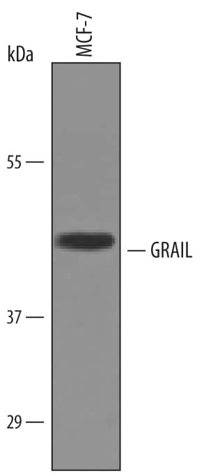 Western blot shows lysates of MCF-7 human breast cancer cell line. PVDF Membrane was probed with 1 µg/mL of Human GRAIL/RNF128 Antigen Affinity-purified Polyclonal Antibody (Catalog # AF6234) followed by HRP-conjugated Anti-Sheep IgG Secondary Antibody (Catalog # HAF016). A specific band was detected for GRAIL/RNF128 at approximately 45 kDa (as indicated). This experiment was conducted under reducing conditions and using Immunoblot Buffer Group 8.