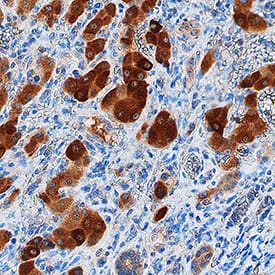Immunohistochemistry GRB7 Antibody [Unconjugated]