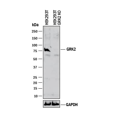 Knockout Validated GRK2 Antibody [Unconjugated]