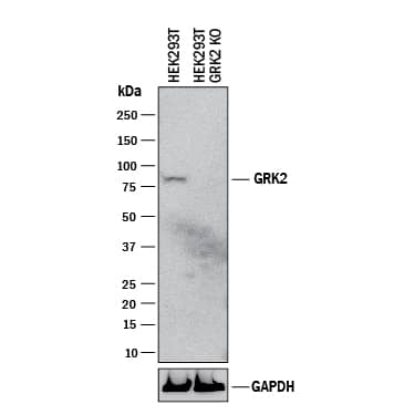 Knockout Validated GRK2 Antibody (2089B) [Unconjugated]