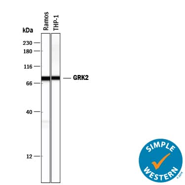 Simple Western GRK2 Antibody (2089B) [Unconjugated]