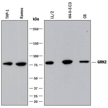 Western Blot GRK2 Antibody (2089B) [Unconjugated]