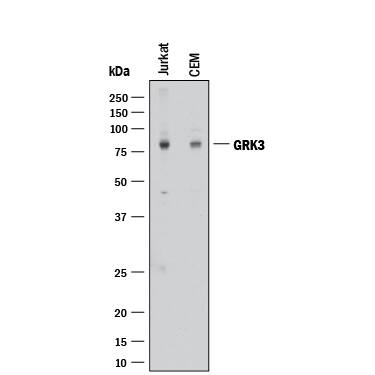 Western Blot GRK3 Antibody [Unconjugated]